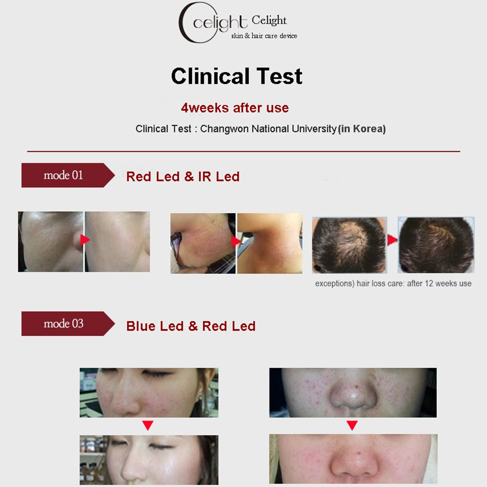 led mask beauty device equipment  Skin Care Hair loss Care Celight